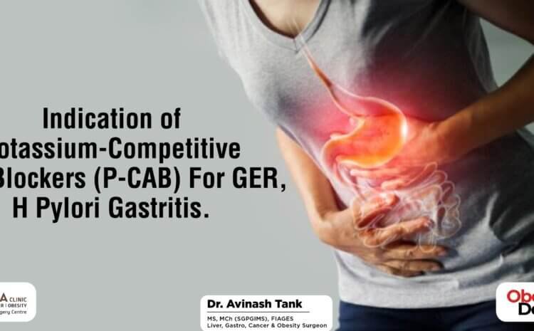 Indication of potassium-competitive acid blockers (P-CAB) For GERD, H pylori Gastritis.