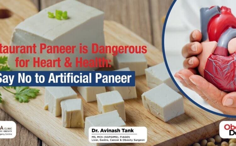 Restaurant Paneer is Dangerous for Heart & Health: Say No to Artificial Paneer