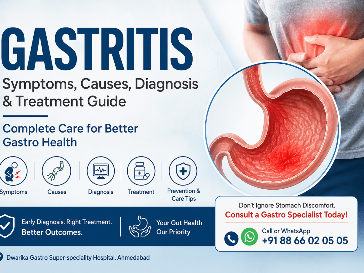 Gastritis: Complete Gastro Health Guide