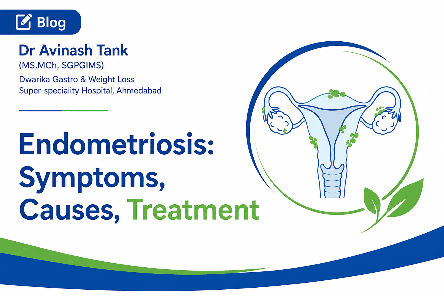 Endometriosis: Symptoms, Causes, Treatment