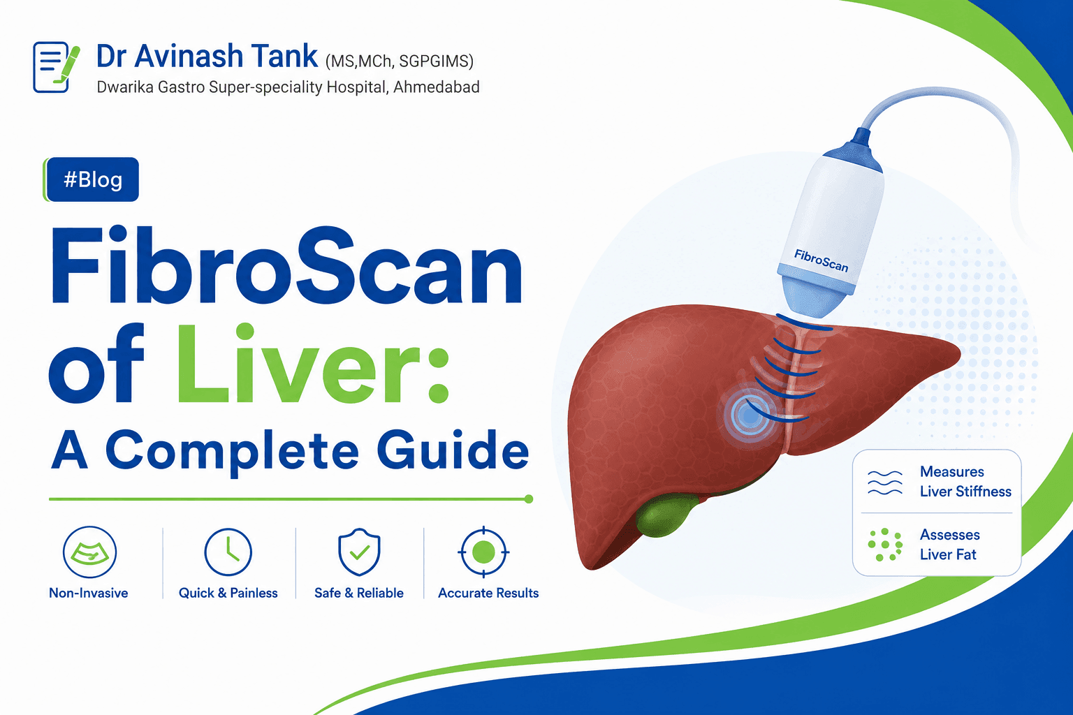 FibroScan of Liver: A Complete Guide