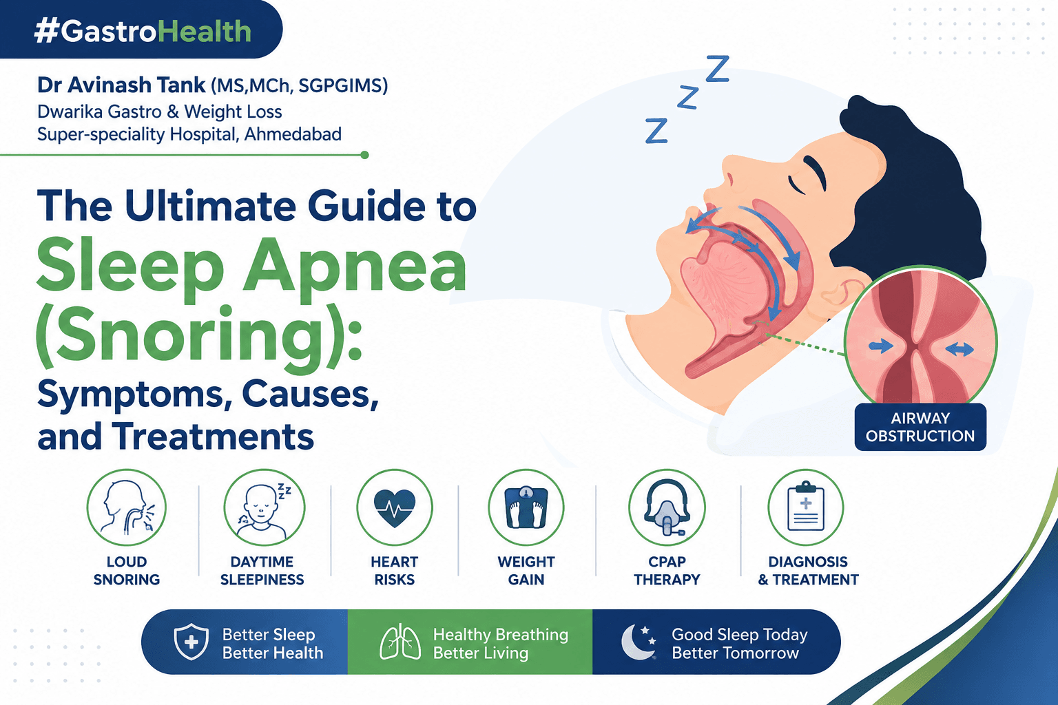 The Ultimate Guide to Sleep Apnea (Snoring)