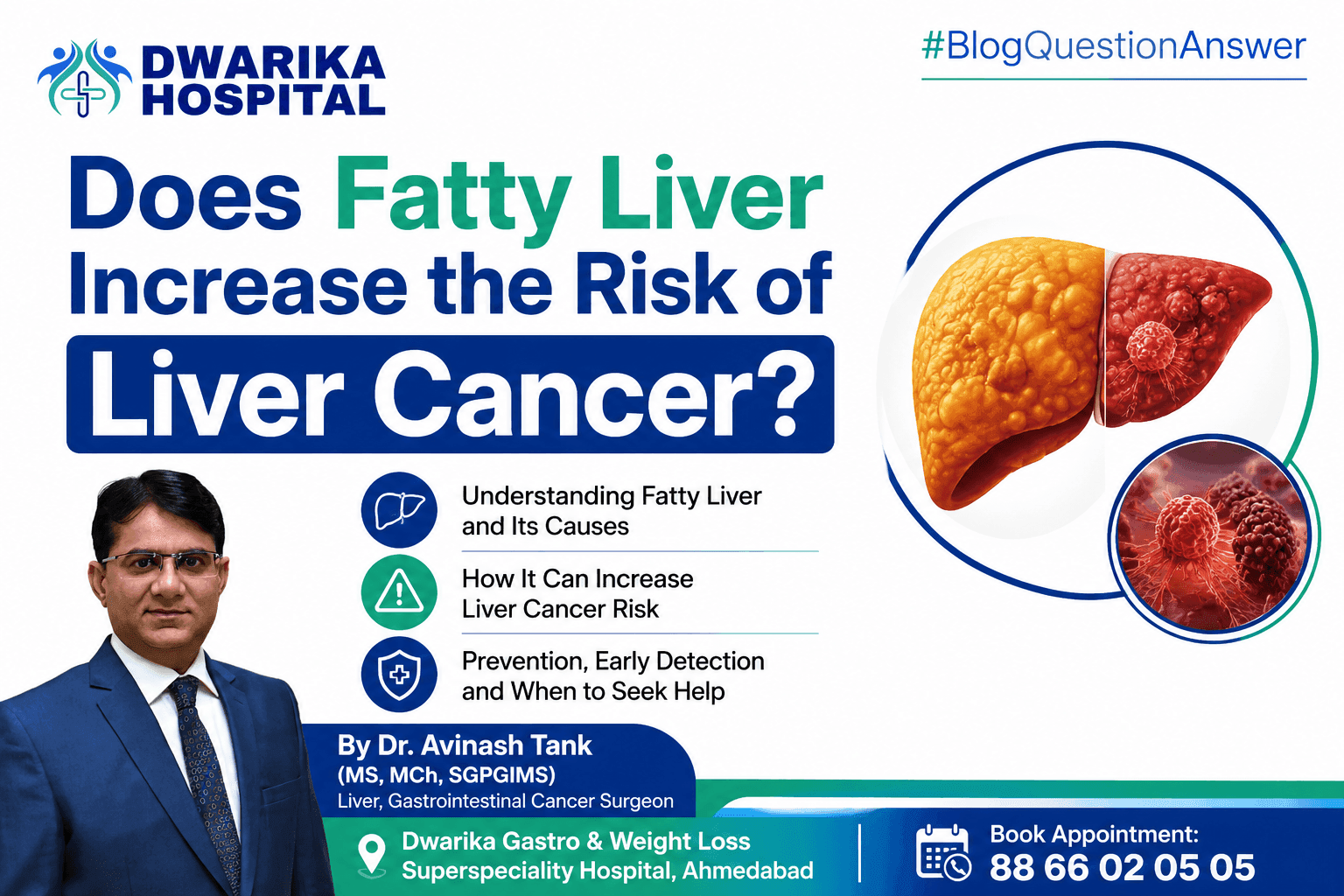 Does Fatty Liver Increase the Risk of Liver Cancer?