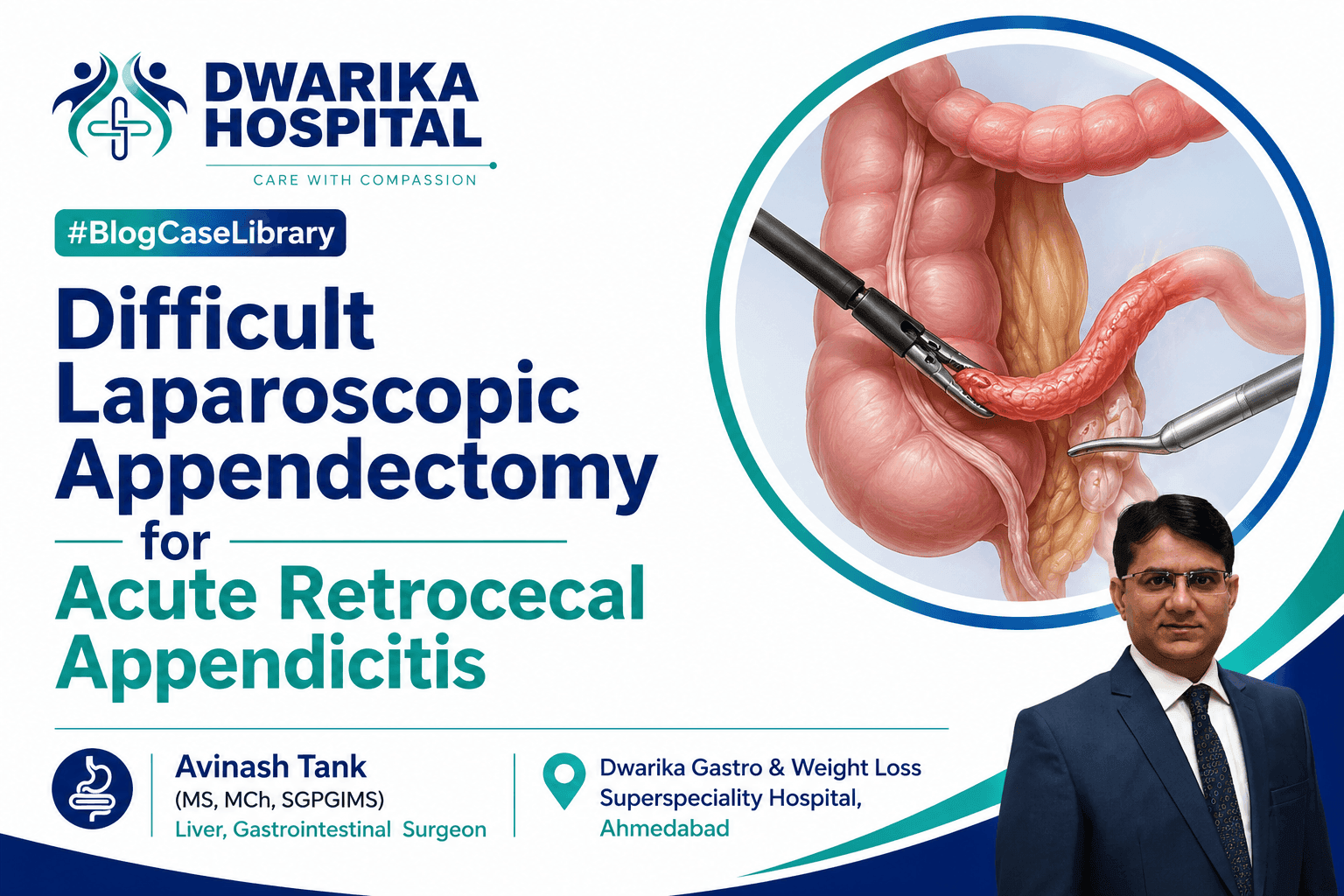 Difficult Laparoscopic Appendectomy for Acute Retrocecal Appendicitis with Dense Periappendiceal Adhesions