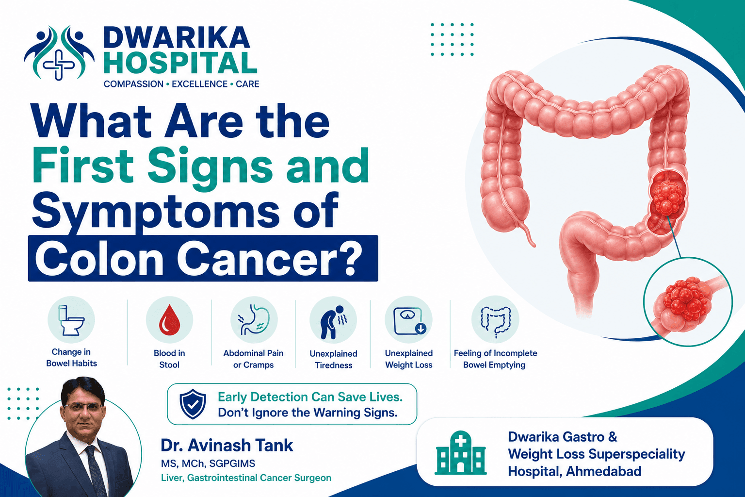 What Are the First Signs and Symptoms of Colon Cancer?